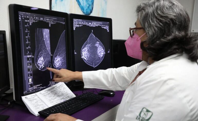 Cuenta IMSS Guanajuato con equipo para prevenir cáncer de mama